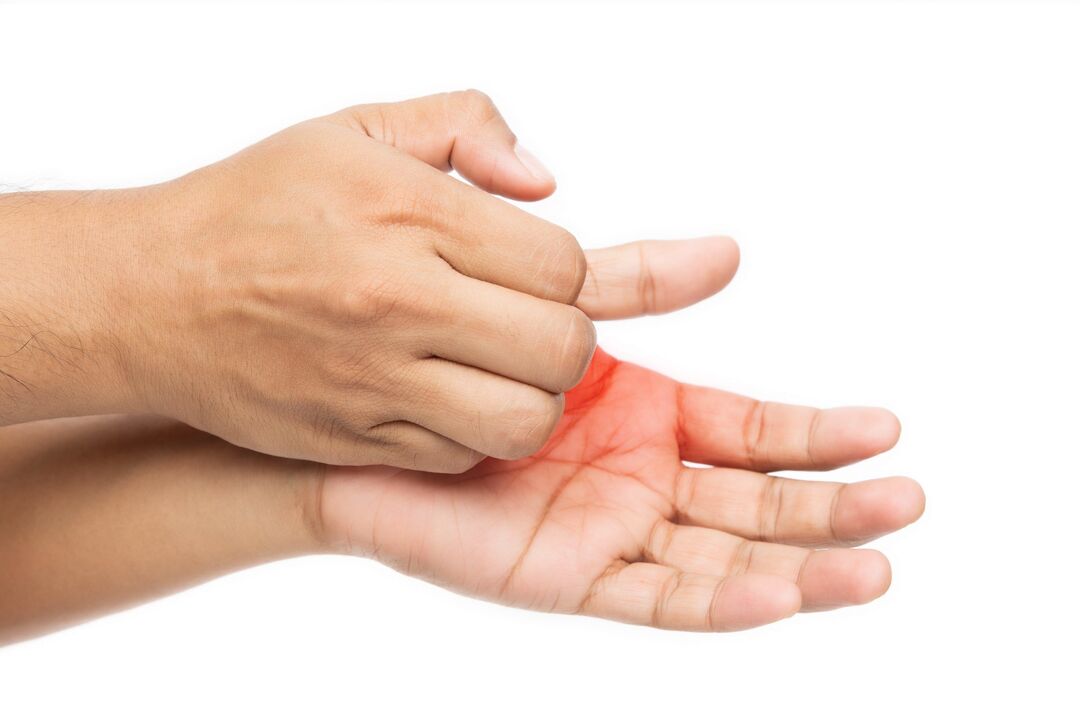 Picazón con cogomelos e o seu tratamento con crema de demyxil